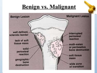 Benign vs. Malignant
 