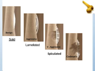 Solid
Lamellated
Spiculated
Benign
Aggressive
V . Aggressive
Codman's
 