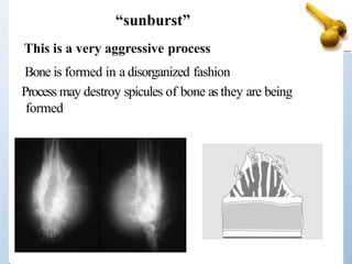 This is a very aggressive process
Bone is formed in a disorganized fashion
Process may destroy spicules of bone as they are being
formed
“sunburst”
 