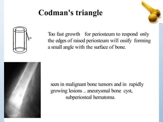 Too fast growth for periosteum to respond only
the edges of raised periosteum will ossify forming
a small angle with the surface of bone.
Codman's triangle
seen in malignant bone tumors and in rapidly
growing lesions .. aneurysmal bone cyst,
subperiosteal hematoma.
 