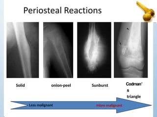 Solid onion-peel Sunburst Codman’
s
triangle
Less malignant More malignant
 