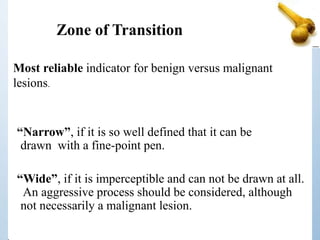 Zone of Transition
Most reliable indicator for benign versus malignant
lesions.
“Narrow”, if it is so well defined that it can be
drawn with a fine-point pen.
“Wide”, if it is imperceptible and can not be drawn at all.
An aggressive process should be considered, although
not necessarily a malignant lesion.
 