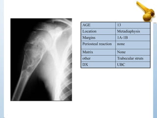 AGE 13
Location Metadiaphysis
Margins 1A-1B
Periosteal reaction none
Matrix None
other Trabecular struts
DX UBC
 