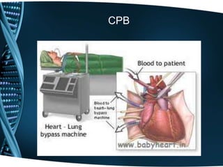 Approach to cardiac surgical diseases | PPT