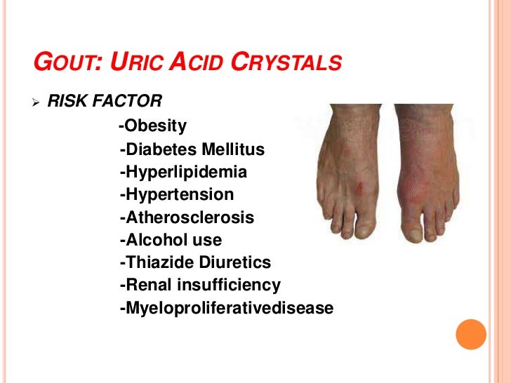Approach to case of arthritis