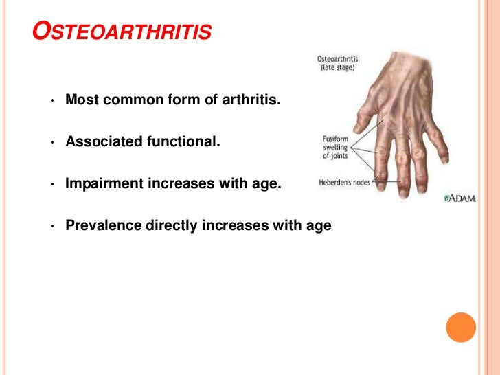 Approach to case of arthritis