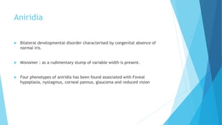 Approach to cases of congenital glaucoma, developmental | PPTX