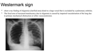Westermark Instrument APPROACH TO CHEST PAIN IN ED ( to present).pptx