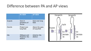 Approach to Chest X-ray interpretation.pptx