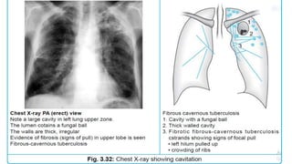 Approach to chest human x ray study .pdf