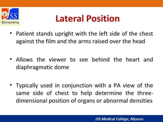 APPROACH TO CHEST X RAYS.pptx