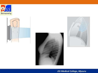 APPROACH TO CHEST X RAYS.pptx