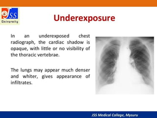 APPROACH TO CHEST X RAYS.pptx