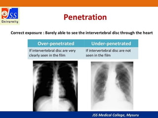 APPROACH TO CHEST X RAYS.pptx