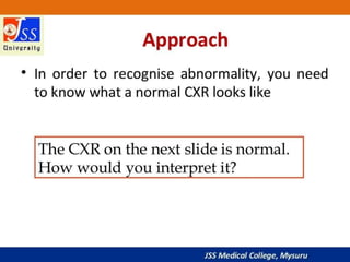 APPROACH TO CHEST X RAYS.pptx