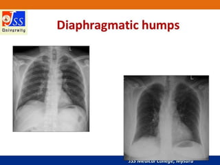APPROACH TO CHEST X RAYS.pptx