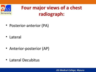 APPROACH TO CHEST X RAYS.pptx