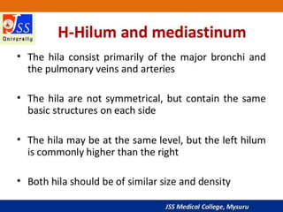 APPROACH TO CHEST X RAYS.pptx