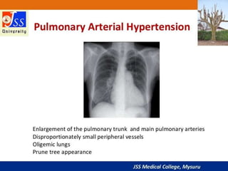 APPROACH TO CHEST X RAYS.pptx