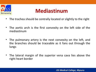 APPROACH TO CHEST X RAYS.pptx