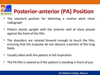 APPROACH TO CHEST X RAYS.pptx