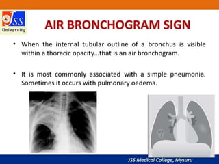 APPROACH TO CHEST X RAYS.pptx