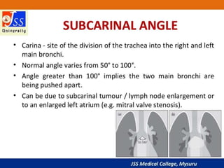 APPROACH TO CHEST X RAYS.pptx