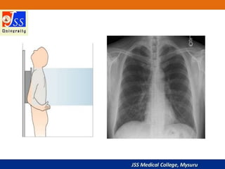 APPROACH TO CHEST X RAYS.pptx