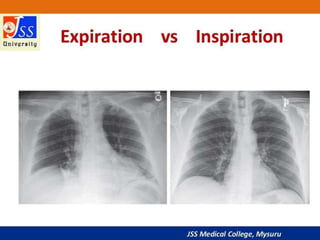 APPROACH TO CHEST X RAYS.pptx