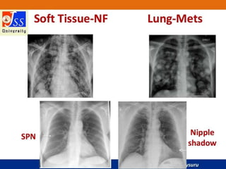 APPROACH TO CHEST X RAYS.pptx