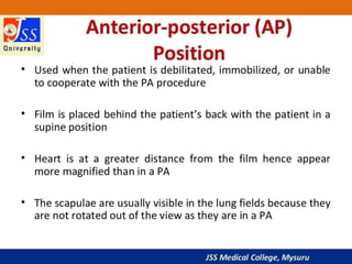 APPROACH TO CHEST X RAYS.pptx