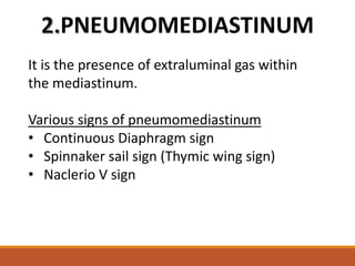 Spinacker Sign APPROACH TO CHEST X RAYS final.pptx
