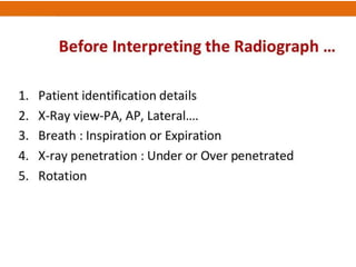 APPROACH TO CHEST X RAYS final.pptx