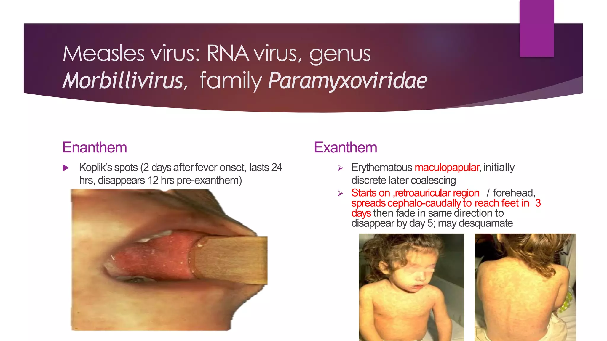 Approach to child – fever with rash | PDF