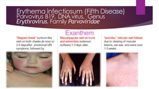 Extensor Rash Approach to child – fever with rash | PDF
