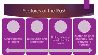 Approach to child – fever with rash | PDF