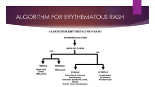 Approach to child – fever with rash | PDF