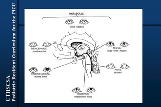 UTHSCSA
PediatricResidentCurriculumforthePICU
 