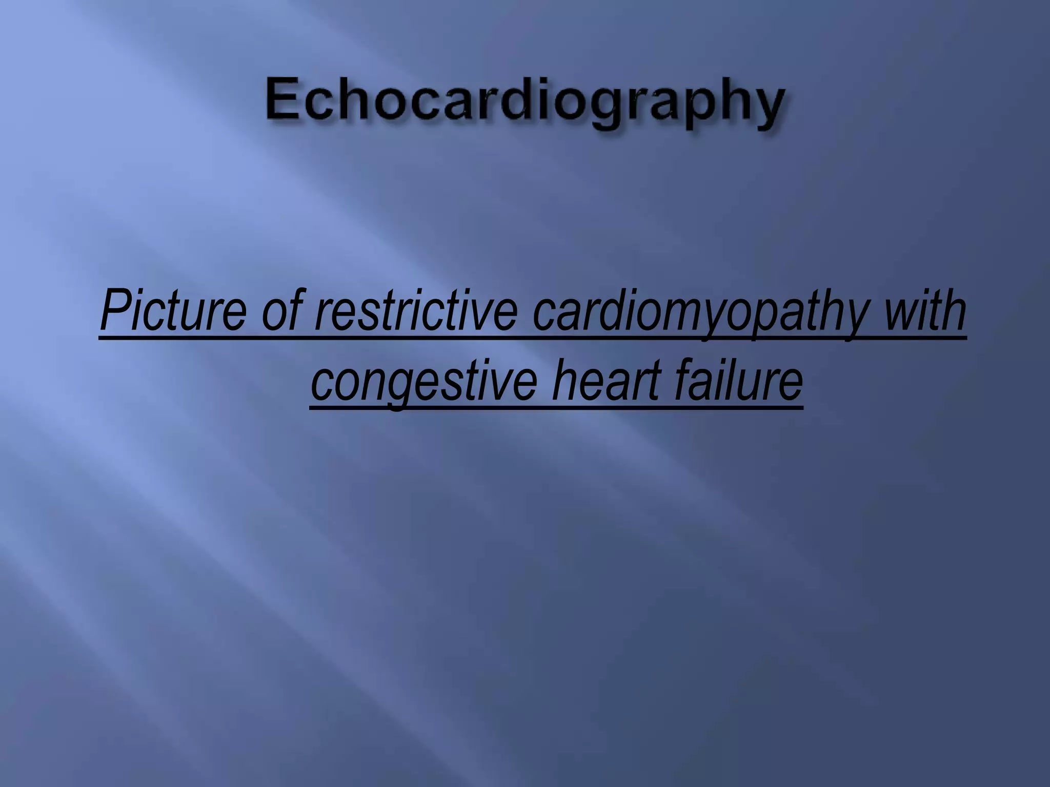 Picture of restrictive cardiomyopathy with
congestive heart failure
 
