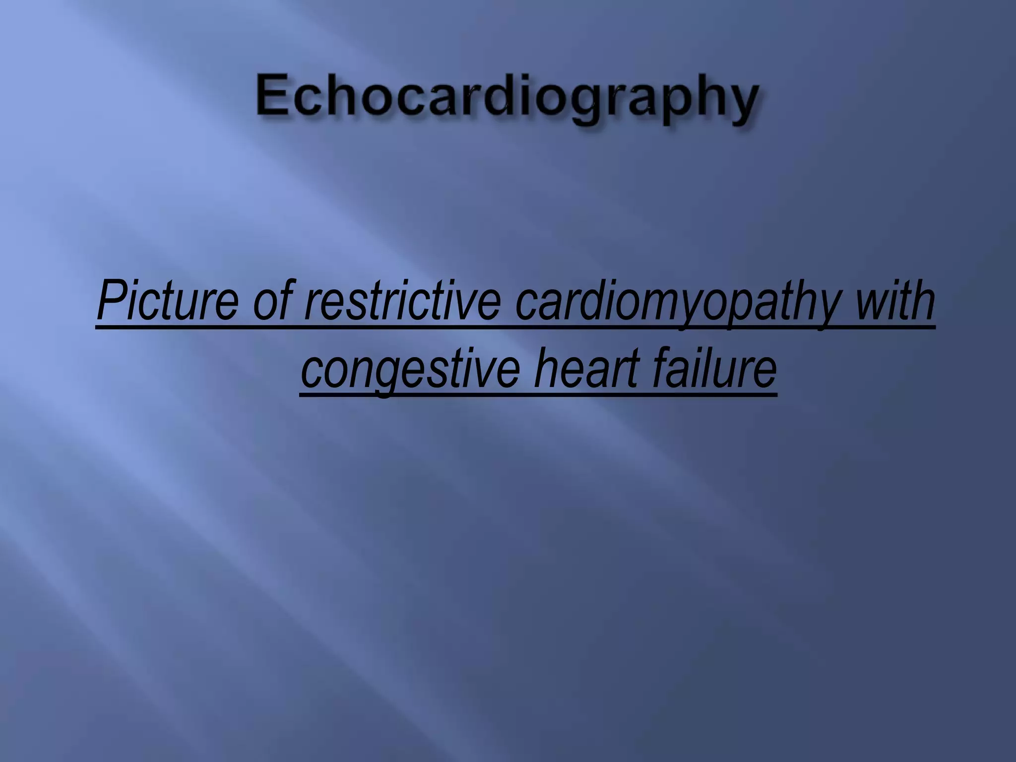 Picture of restrictive cardiomyopathy with
congestive heart failure

 