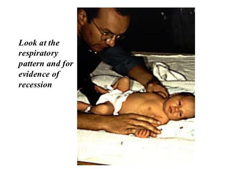 Approach to child with heart disease