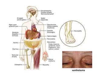 xanthelasma

 