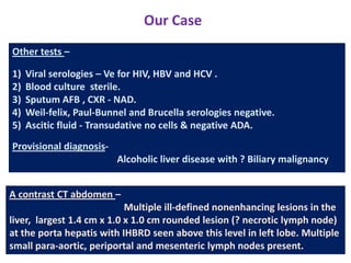 Our Case
Other tests –
1)
2)
3)
4)
5)

Viral serologies – Ve for HIV, HBV and HCV .
Blood culture sterile.
Sputum AFB , CXR - NAD.
Weil-felix, Paul-Bunnel and Brucella serologies negative.
Ascitic fluid - Transudative no cells & negative ADA.

Provisional diagnosisAlcoholic liver disease with ? Biliary malignancy
A contrast CT abdomen –
Multiple ill-defined nonenhancing lesions in the
liver, largest 1.4 cm x 1.0 x 1.0 cm rounded lesion (? necrotic lymph node)
at the porta hepatis with IHBRD seen above this level in left lobe. Multiple
small para-aortic, periportal and mesenteric lymph nodes present.

 