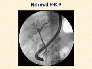 Normal ERCP

 