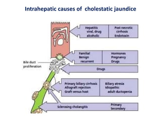 Intrahepatic causes of cholestatic jaundice

 