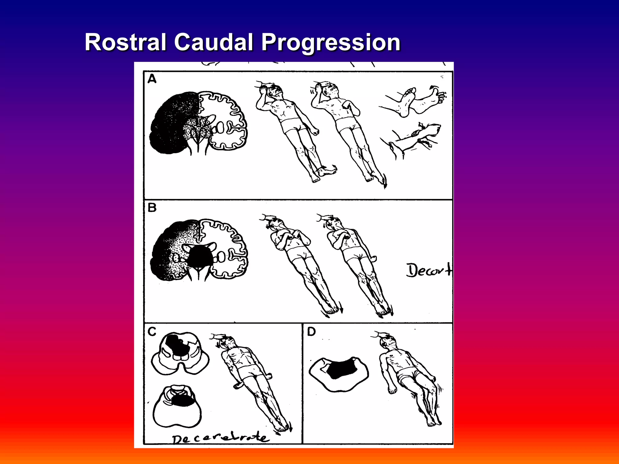 Rostral Caudal Progression