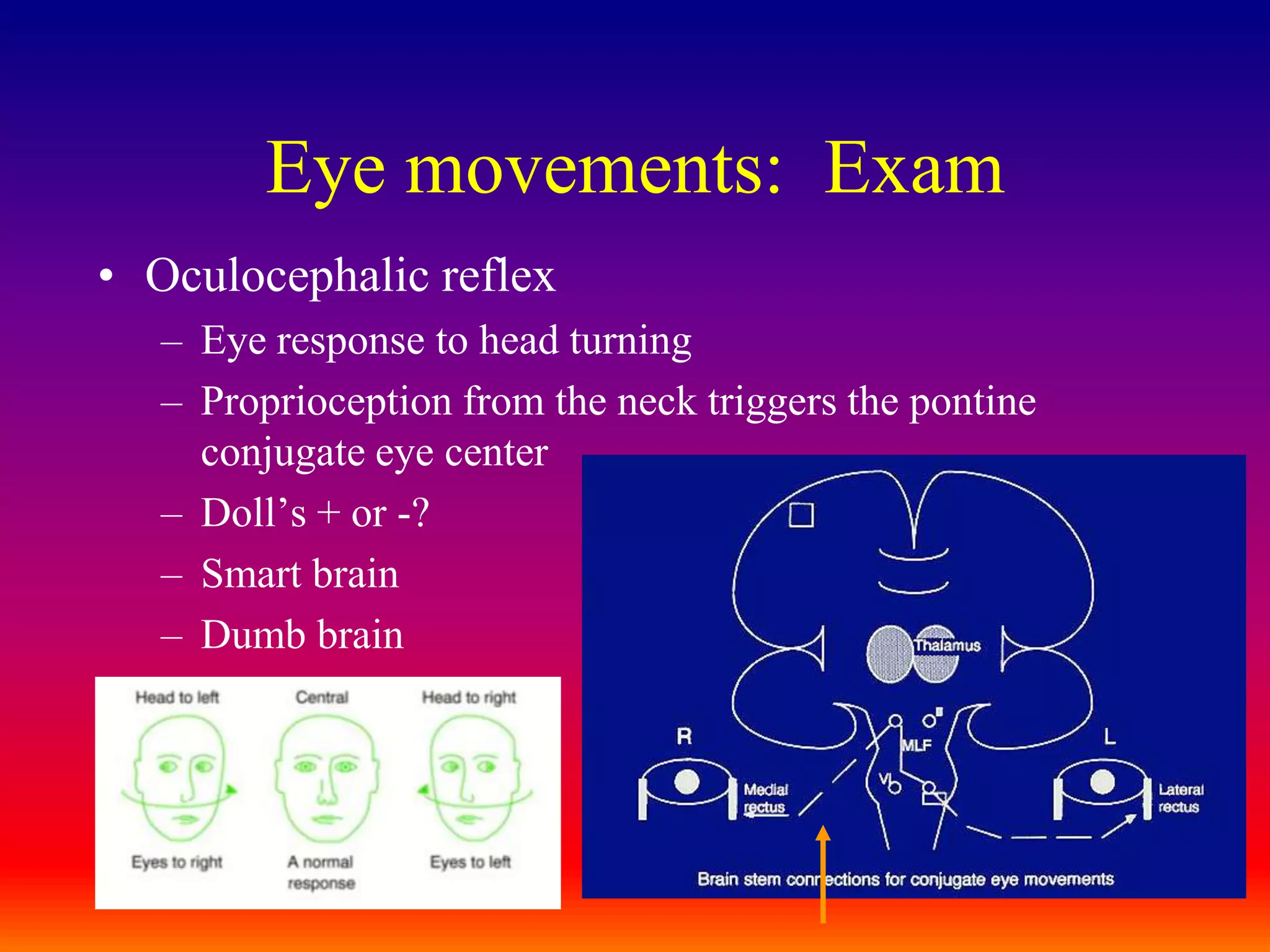 Eye movements:  ExamOculocephalic reflexEye response to head turningProprioception from the neck triggers the pontine conjugate eye centerDoll’s + or -?Smart brainDumb brain