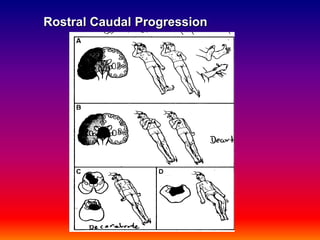 Rostral Caudal Progression