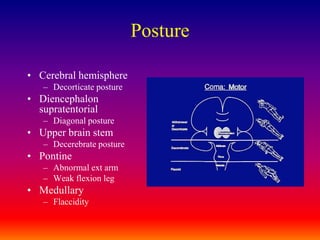 PostureCerebral hemisphere Decorticate postureDiencephalon supratentorial Diagonal postureUpper brain stem Decerebrate posturePontineAbnormal ext armWeak flexion legMedullaryFlaccidity