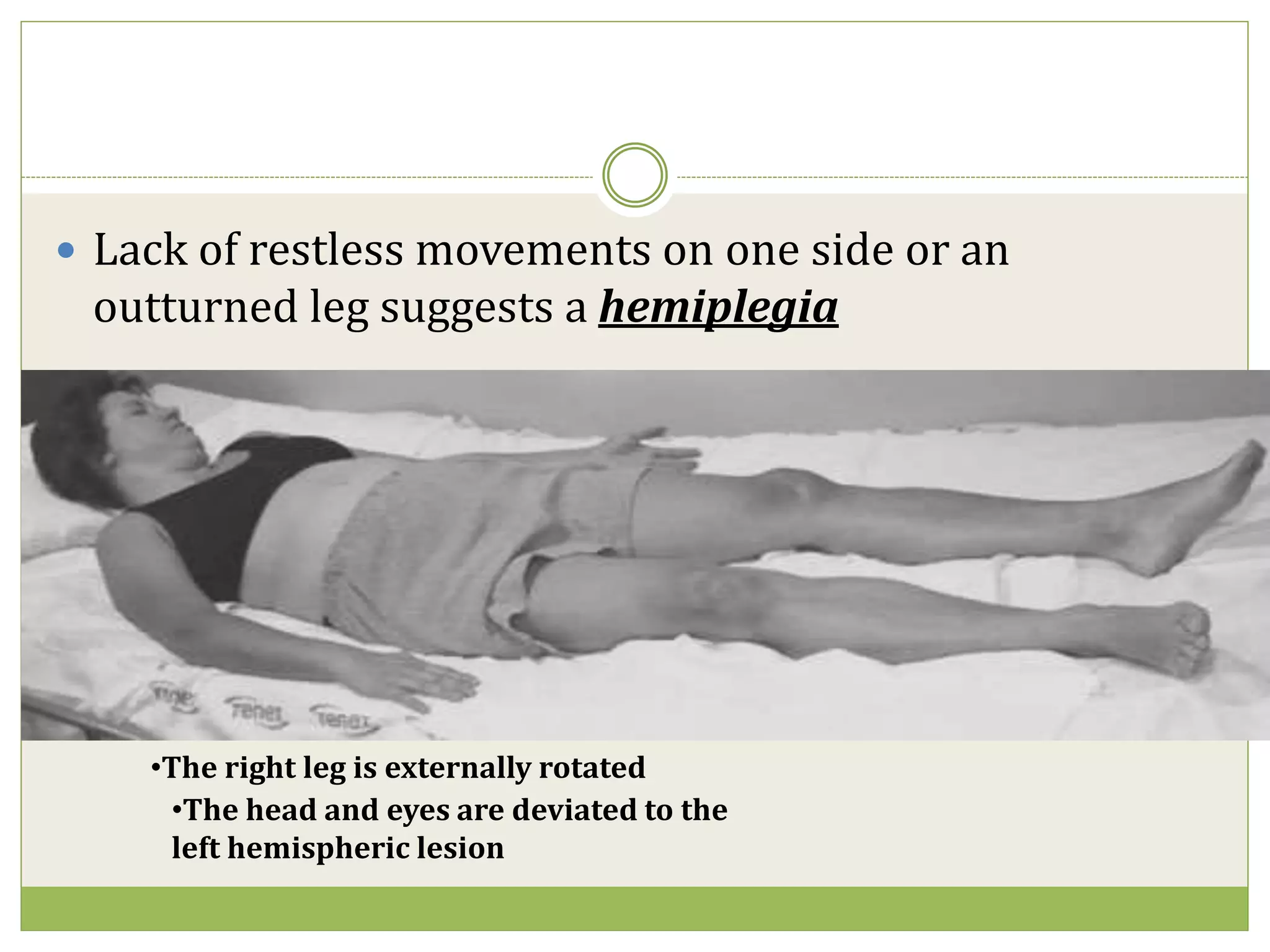 Approach to coma | PPTX